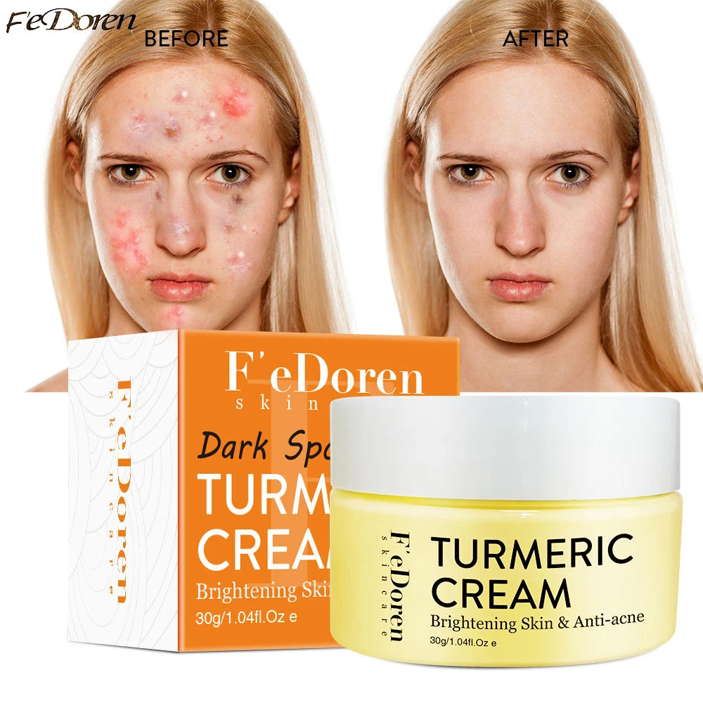 Turmeric Moisturizer Whitening Face Turmeric day & night Cream For Dark Spot anti-wrinkle Acne pigmentation corrector skin care