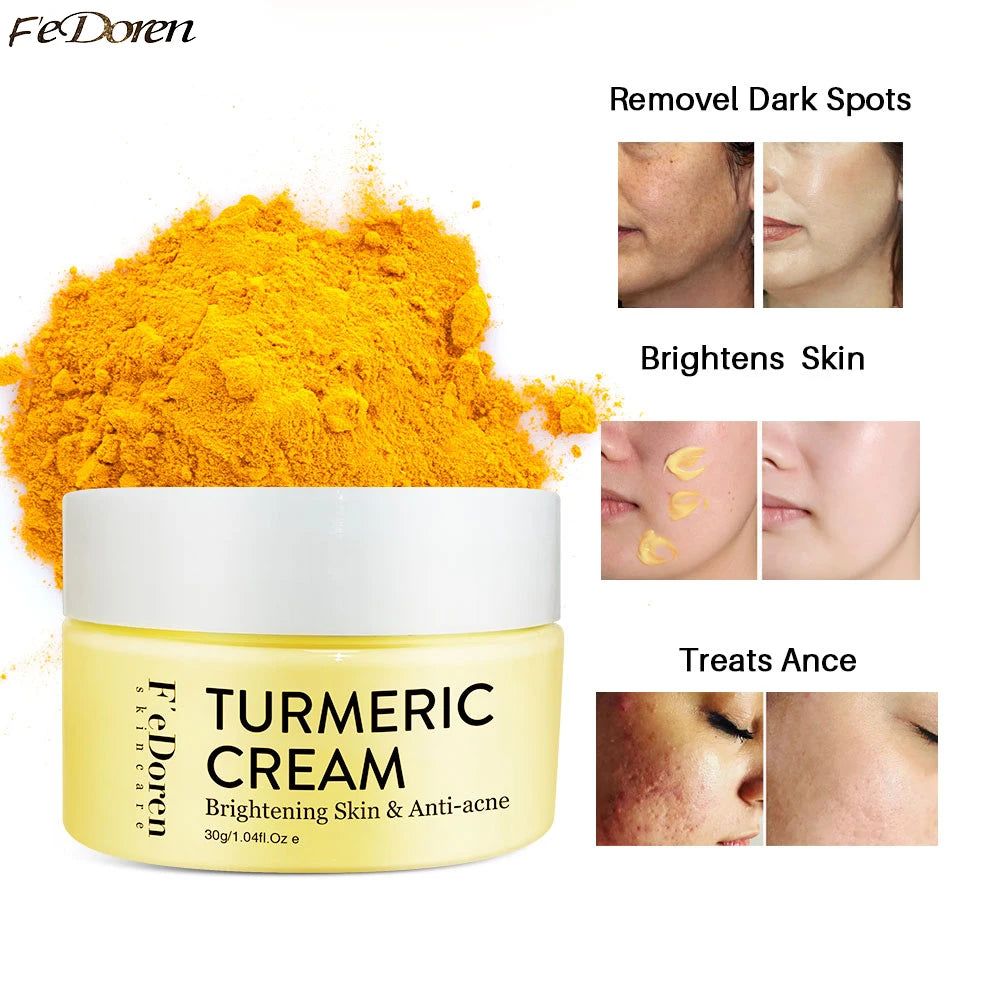 Turmeric Moisturizer Whitening Face Turmeric day & night Cream For Dark Spot anti-wrinkle Acne pigmentation corrector skin care