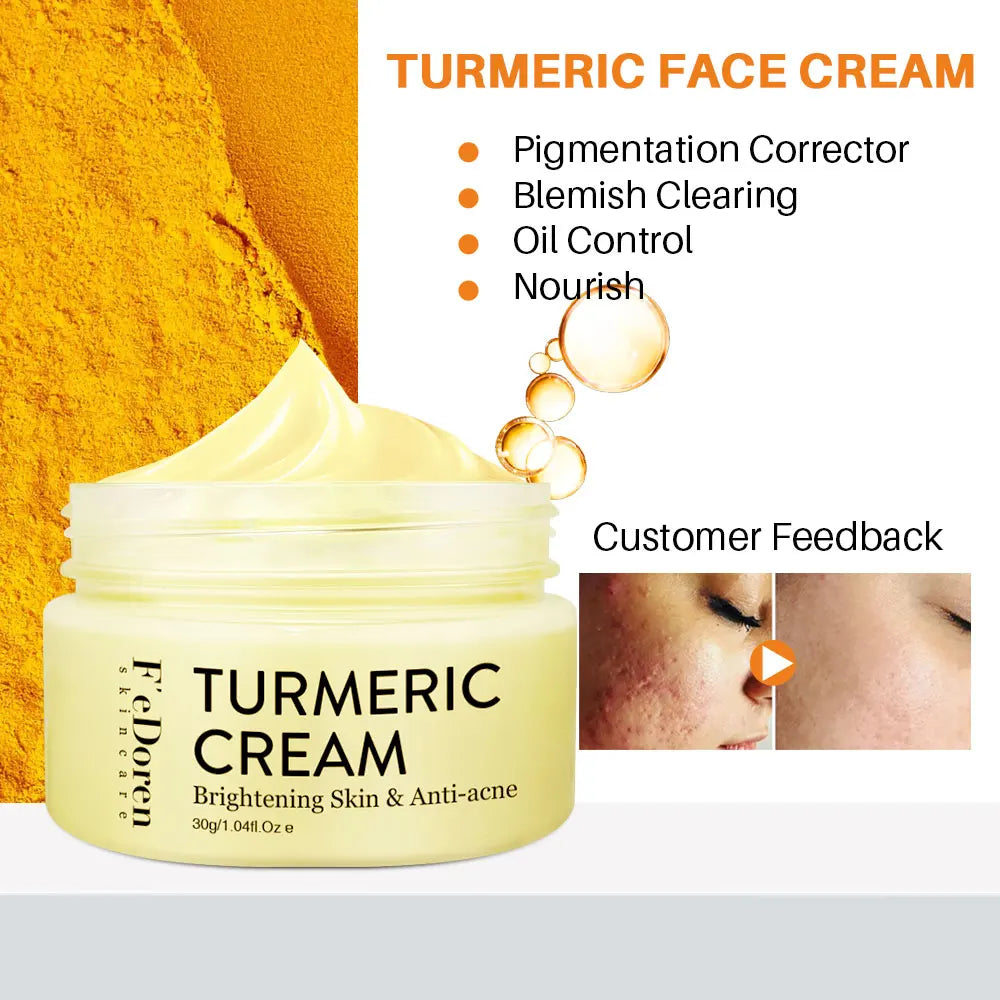 Turmeric Moisturizer Whitening Face Turmeric day & night Cream For Dark Spot anti-wrinkle Acne pigmentation corrector skin care