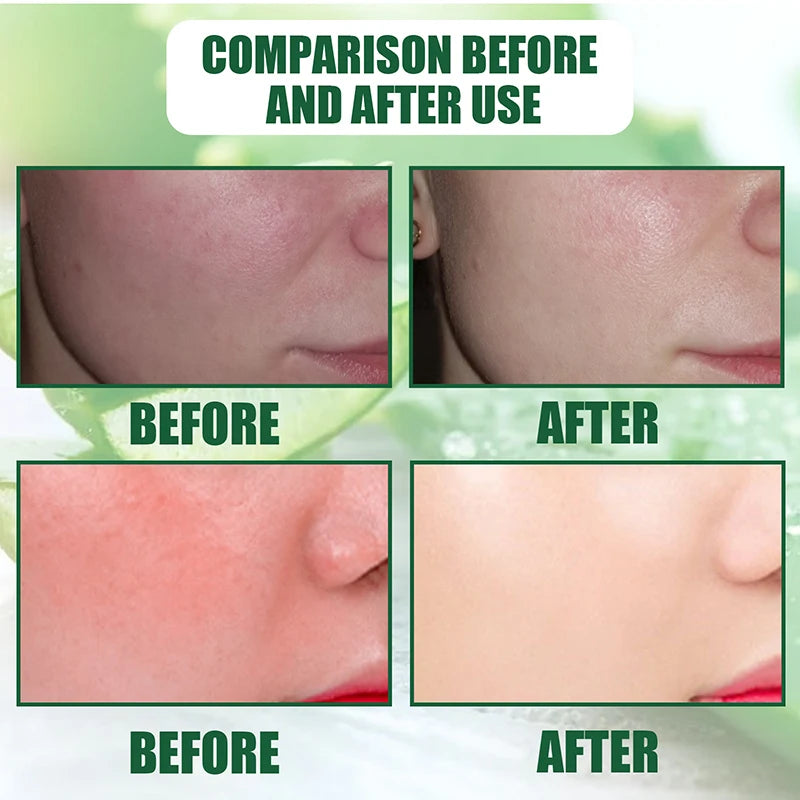 Aloe Vera Toner Spray Face Mists Sun Repair Sensitive Skin Improve Aloe Seurm Spray Moisturizing Sooth Skin Care Korean Cosmetic
