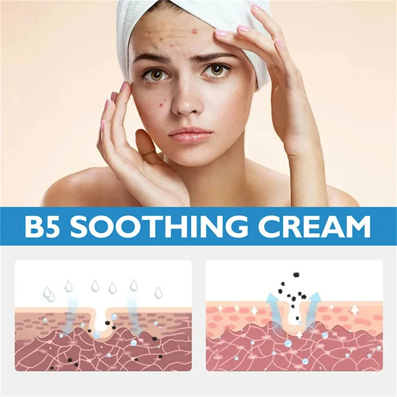 Effective Whitening Freckle Cream Remove Melasma Dark Spots Cream Fade Melanin Moisturize Brighten Smooth Beauty Face Skin Care