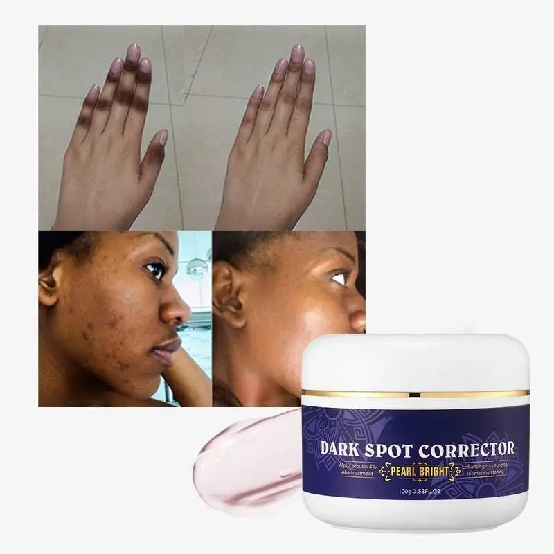 Removal 7 Days Dark Spot Corrector Skin Care Private Label Whitening Freckle Face Cream
