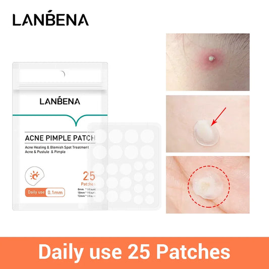 LANBENA Acne Pimple Patch Beauty Tool Invisible Acne Stickers Blemish Treatment Acne Master Face Mask Skin Care 25pcs Daily Use