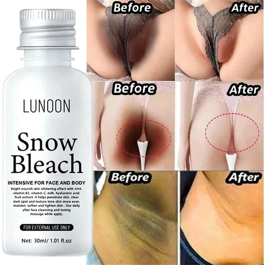 Whitening Cream Private Parts Underarm Bleaching Serum Whiten Butt Knee Brighten Inner Thigh Intimate Parts Dark Remove Melanin