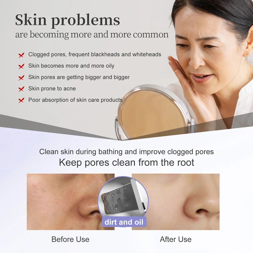 ANLAN Ultrasonic Skin Scrubber Peeling Facial Ultrasonic EMS Face Lifting LED Therapy Skin Care Pore Deep Cleansing Machine IPX7