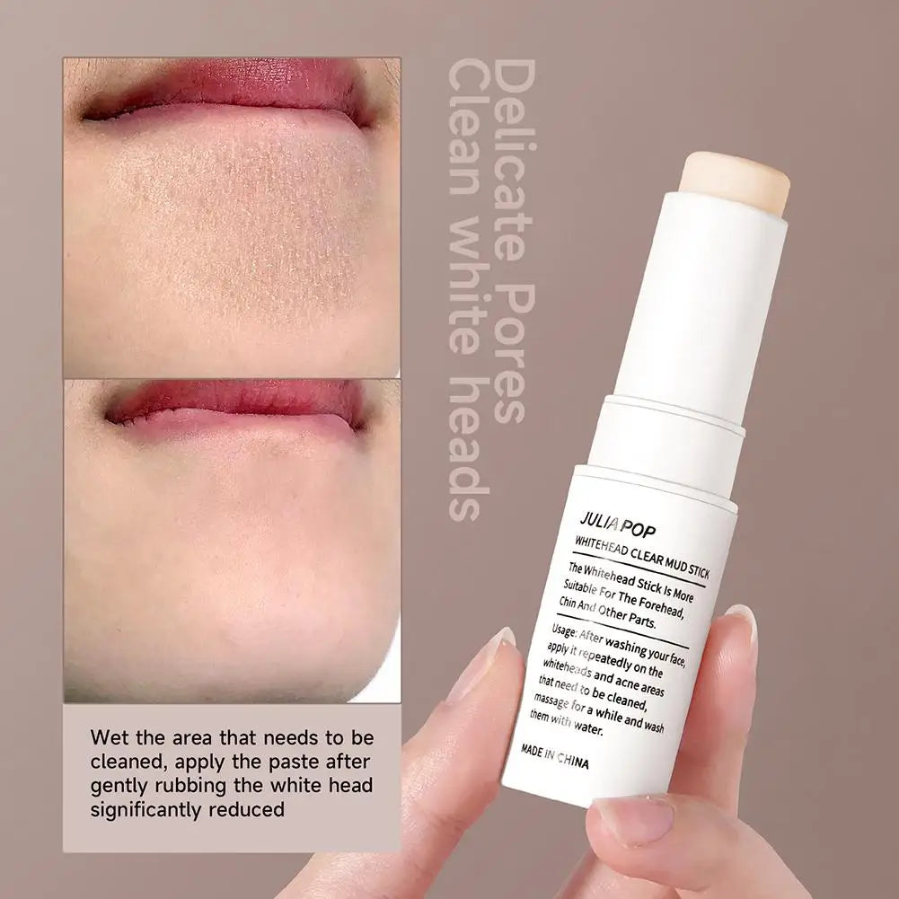 Acne Removal Multi Balm Stick Blackhead Acne Treatment Deep Cleansing Oil Control Moisturizing Makeup Remover Korean Cosmetics