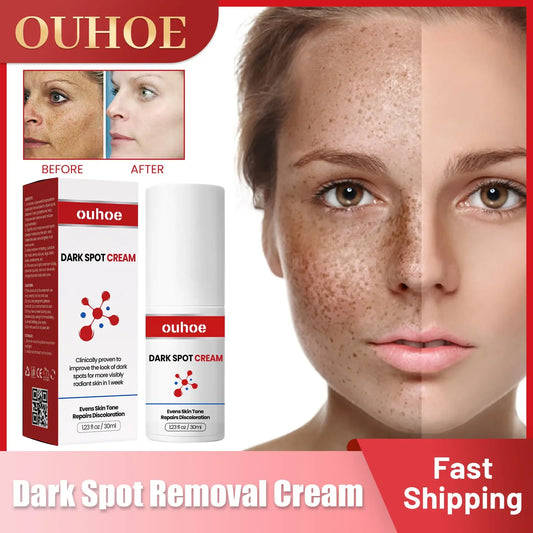 Dark Spot Remover Cream for Face Whiten Freckles Pigment Melanin Correcting Facial Essence Fade Age Spots Brighten Skin Care 30g