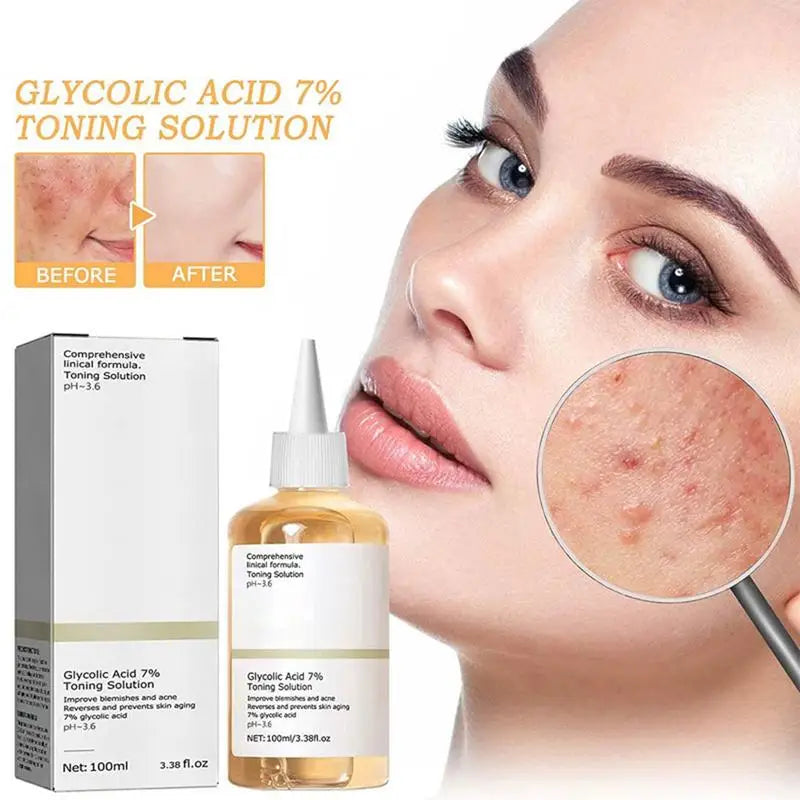 Toner Remove Acne Fade Acne Glycolic Acid 7% Marks Improve Skin Hydrating Whitening Moisturize Toning Ordinary Original Products
