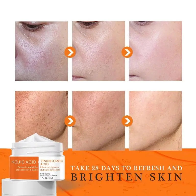 Anti Freckle Pearl Skin Brightening Cream Remove Face Spot Brighten Skin Contain Herbal Serum Skin Care Face Essence