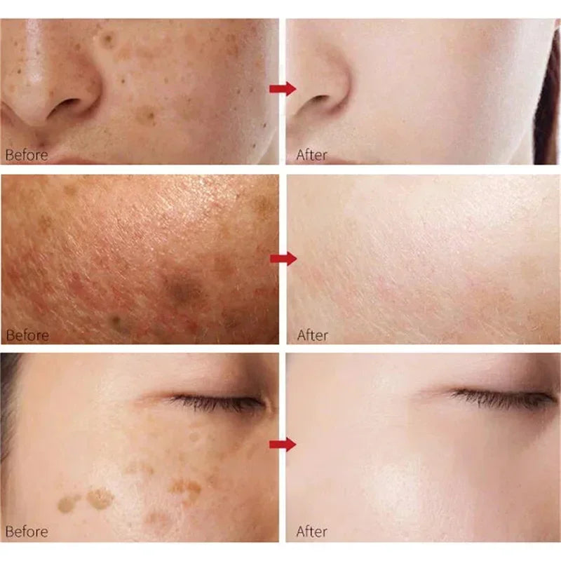 White Rice Whitening Face Cream Remove Dark Spots Fade Freckle Melanin Anti Wrinkle Aging Moisturizing Brighten Skin Care New