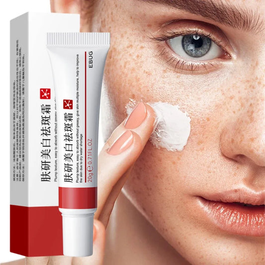 Face Dark Spots Remover for Women Remove Melasma Freckles Cream Removal Melanin Whitening Cream Fade Spots Skin Brightening Care