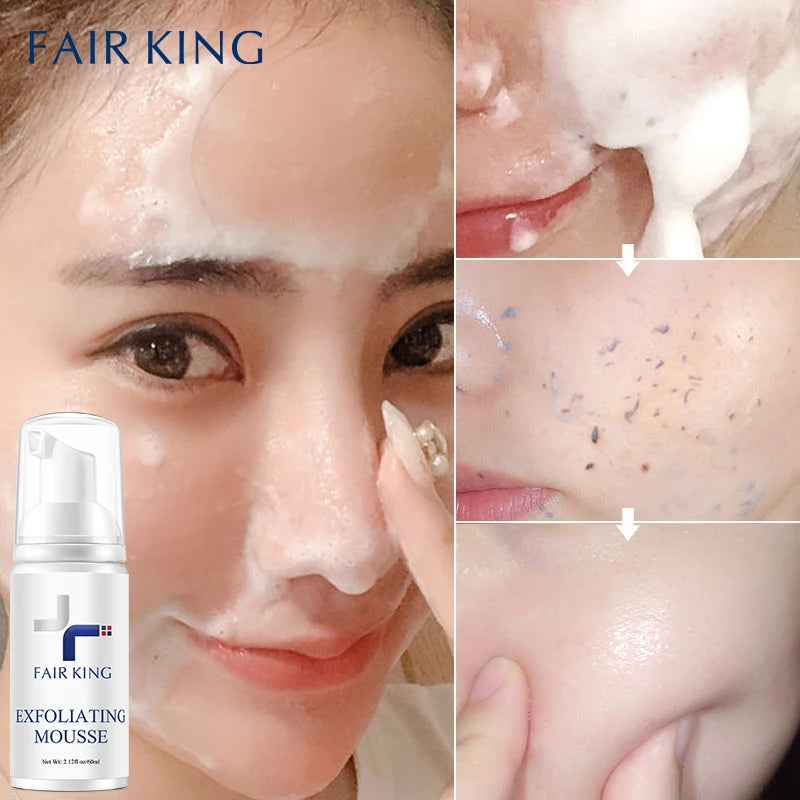 FAIR KING Facial Exfoliating Mousse Facial Cleanser Exfoliator For Face Scrub Deep Remove Cleaning All Skin Types Smooth Moistur
