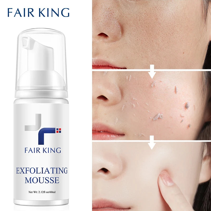 FAIR KING Facial Exfoliating Mousse Facial Cleanser Exfoliator For Face Scrub Deep Remove Cleaning All Skin Types Smooth Moistur