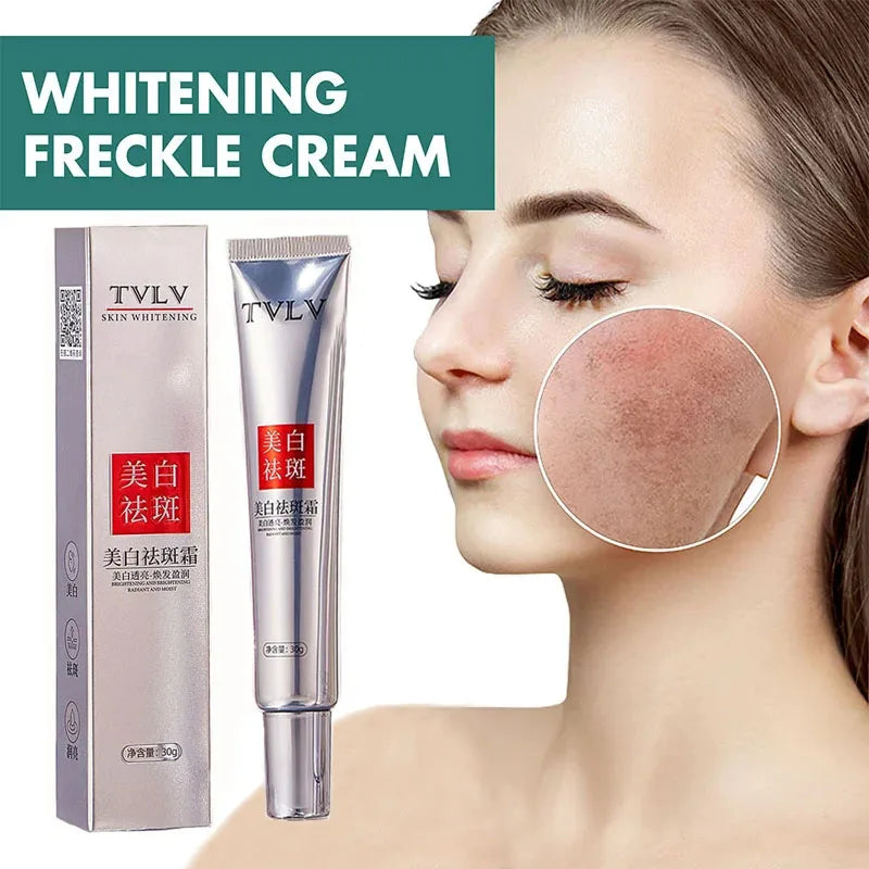 Nicotinamide Whitening Freckles Cream Remove Melasma Dark Spot Acne Marks Lightening Melanin Brightens Skin Tone Face Skin Care
