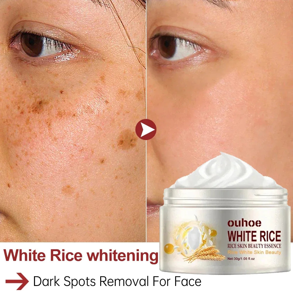 White Rice Whitening Face Cream Remove Dark Spots Fade Freckle Melanin Anti Wrinkle Aging Moisturizing Brighten Skin Care New