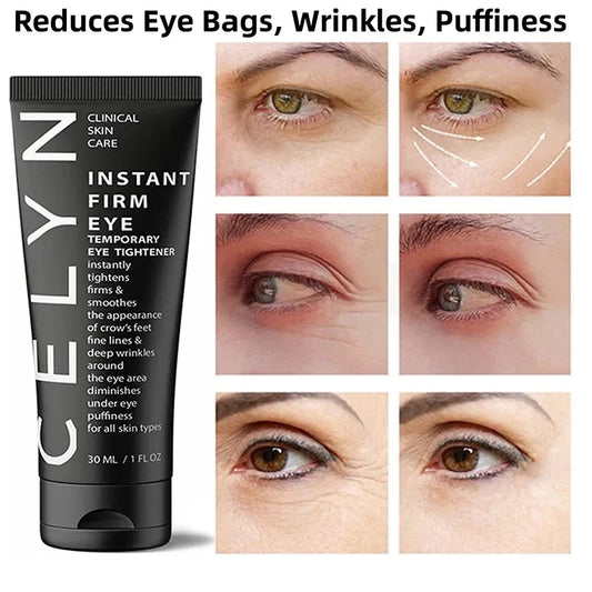 CËLYN Eye Cream Removes Dark Circles Tightens The Eyes Lifting Firming And Removing Eye Bags Make Your Eyes More Lively