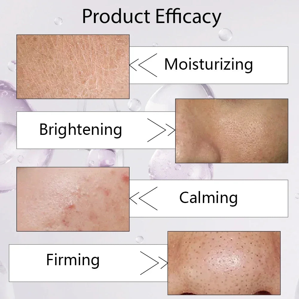 Plant 20% Niacinamide Face Serum Hyaluronic Acid Lifting Moisturizing Skin Care Niacinamide Facial Serum Skincare Products