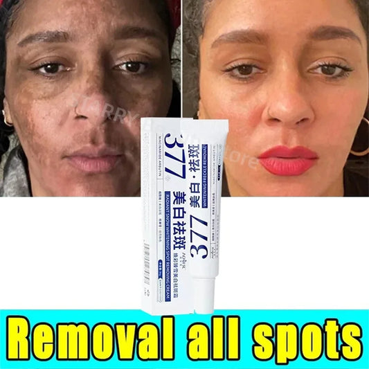 Whitening Freckle Cream Effective Remove Melasma Cream Remove Dark Spots Melanin Moisturize Brighten Smooth Face Skin Care