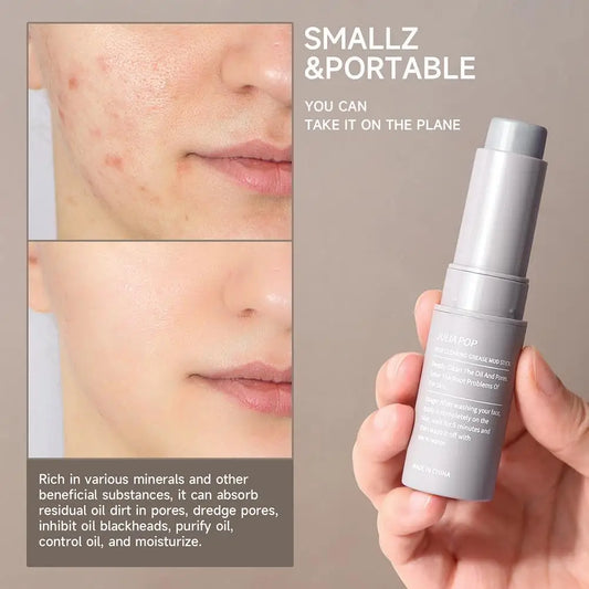 Acne Removal Multi Balm Stick Blackhead Acne Treatment Deep Cleansing Oil Control Moisturizing Makeup Remover Korean Cosmetics