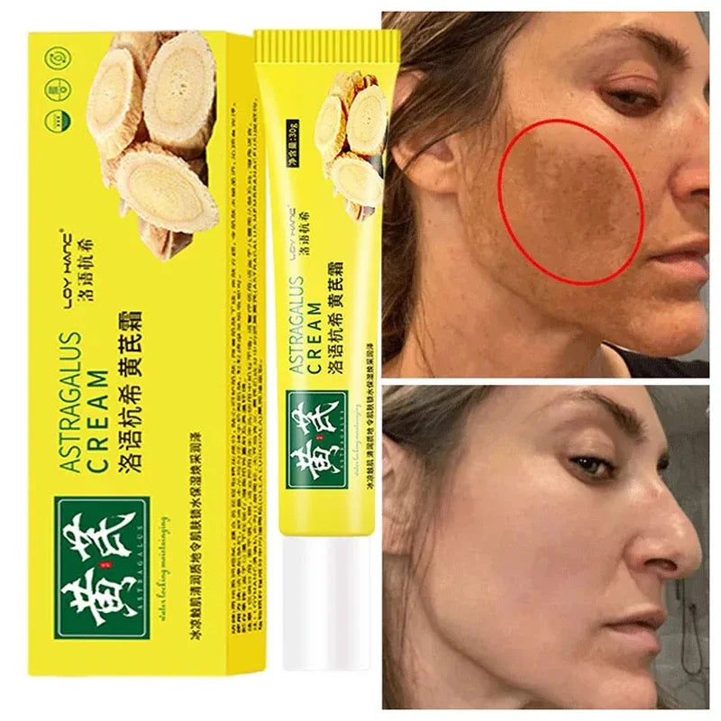 Astragalus Whitening Cream Freckles Remove Melasma Fade Dark Spot Dark Yellow Skin Brighten Anti-aging Moisturize Face Skin Care