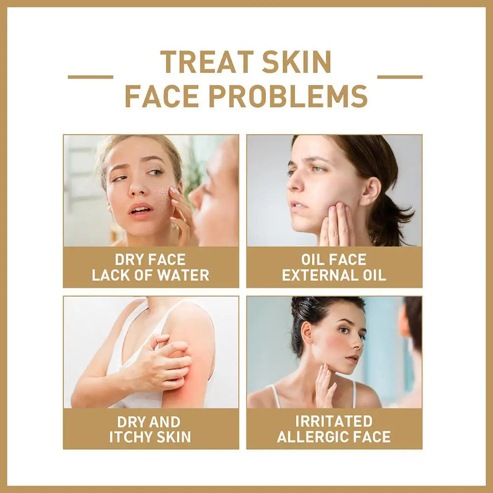 150ml Rice Face Toner Anti-aging Moisturizing Essential Toner Facial Skin Care Brighten Improve Fine Line Korean Cosmetics