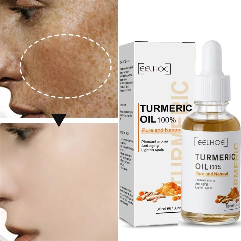 Freckle Remove Turmeric Serum Curcumin Oil Face Whitening Brighten Moisturizing Fade Dark Spot Removal Melaninskin Turmeric Oil