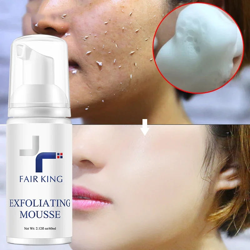 Face Exfoliating Mousse Foaming Deep Cleaning Skin Wash Face Smooth Moisturizing Bright Skin Exfoliator Unblock Pores Cleanser