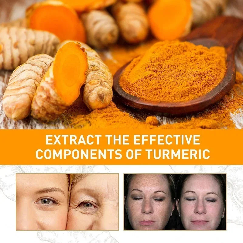 3pcs Turmeric Toner Brightening Face Serum Dark Corrector Moisturizing Vitamin C Ginger Essence Skin Lightener Korean Cosmetics