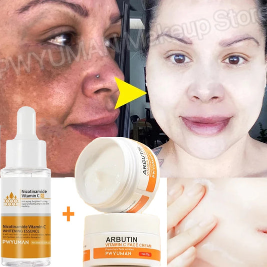 Vitamin C Whitening Freckles Serum Cream Remove Dark Spots Melasma Niacinamide Lighten Melanin Acne Scars Anti-aging Skin Care