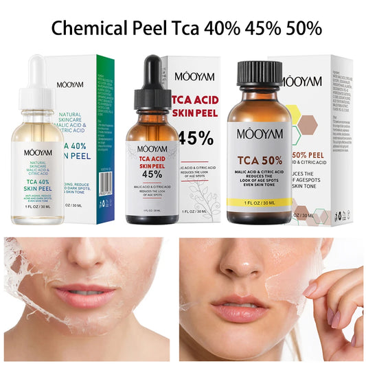 30ml Chemical Peel 40% 45% 50% Facial Peeling Serum Citric Acid Peeling Solution Face Exfoliator Facecare Product