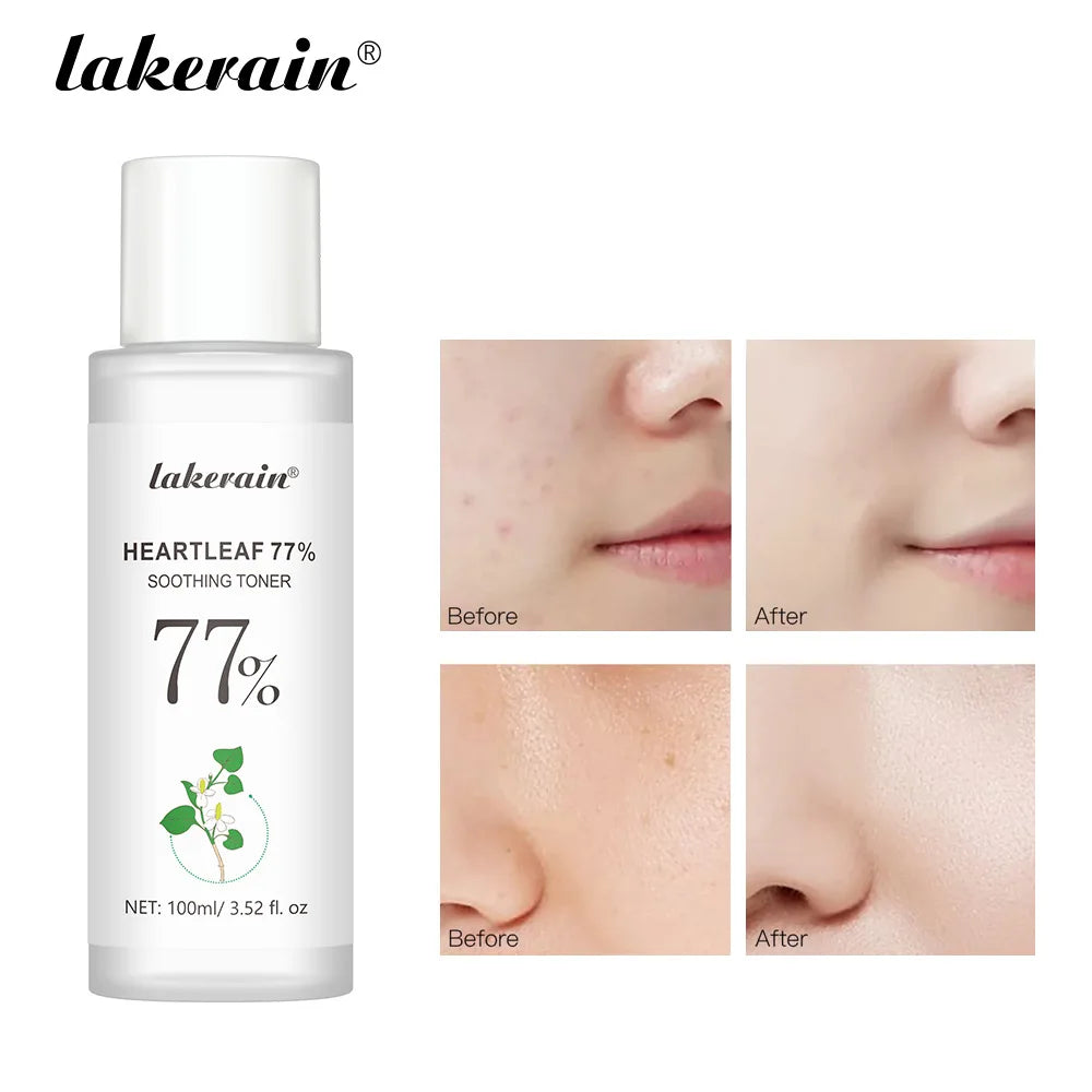 100ml Heartleaf 77% Soothing Toner Organic Soothing Refreshing Toner Remove Dead Skin Moisturize Close Pores