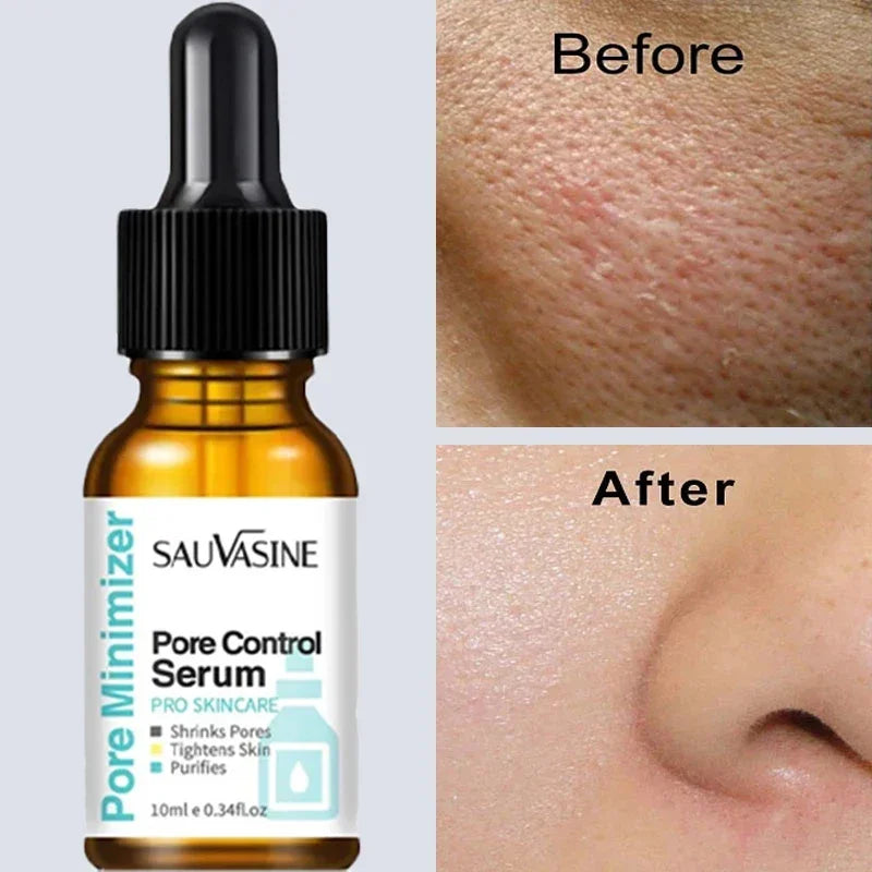 Removing Large Pores Pore Shrinking Serum Face Tightening Repairing Facial Pore Minimizing Moisturizing Skin Care Beauty New