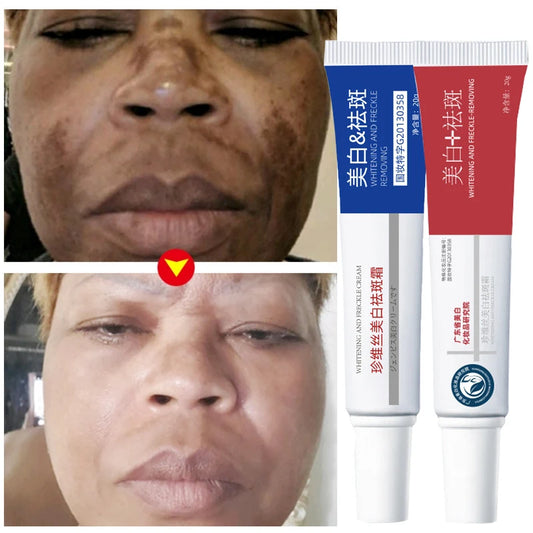 Freckle Whiten Cream Effective Removing Spot Eliminate Brown Stain Melasma Melanin Blemishes Lighten Moisturiser Face Skin Care