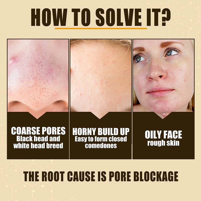 Pore Minimising Essence Refining Skin Reducing Pores Preventing Enlarged Pores Repairing Facial Skin Moisturising Skin Care