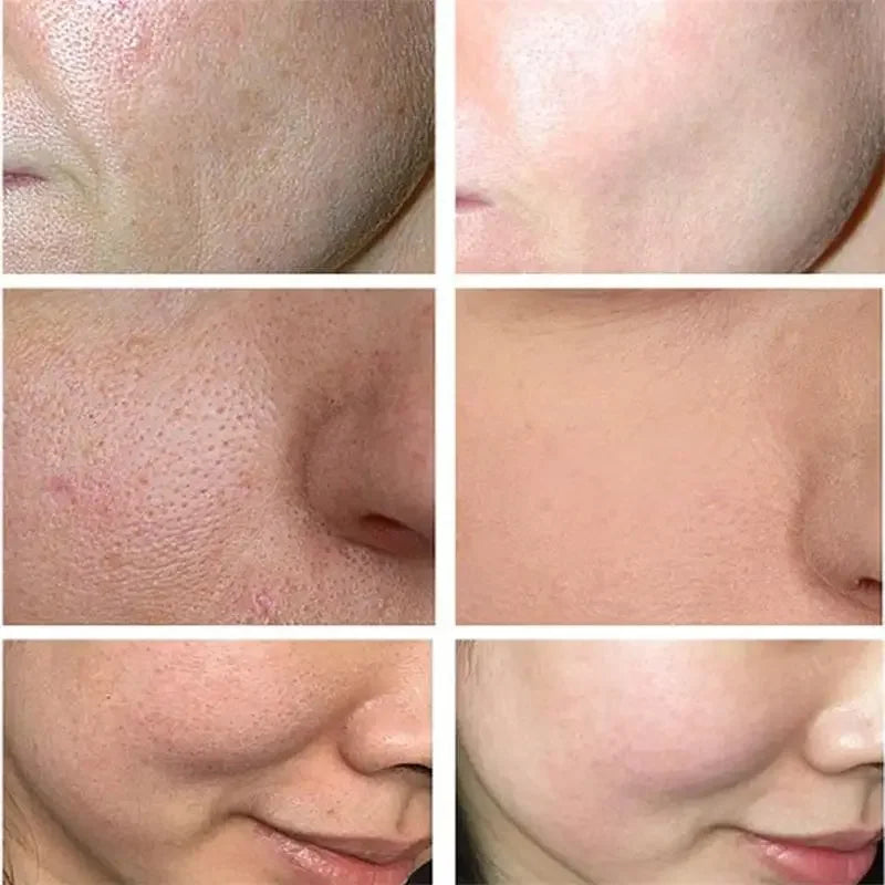 Japan Sakura Wrinkle Remover Face Serum Cream Anti-Aging Fade Fine Lines Lift Firming Vitamin C Whitening Rejuvenation Skin Care