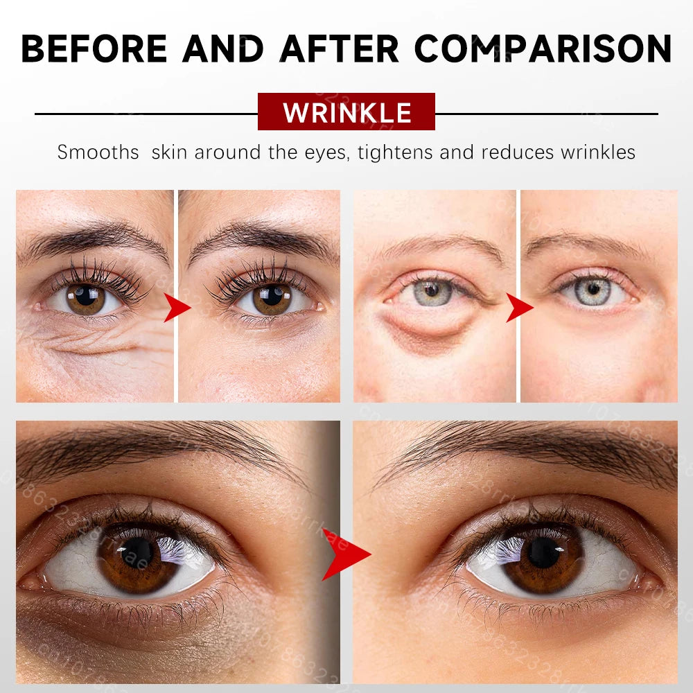 Eye cream removes eye bags puffiness dark circles eye wrinkles, Fade Eye Fine Line,  Anti Wrinkle whitens skin care