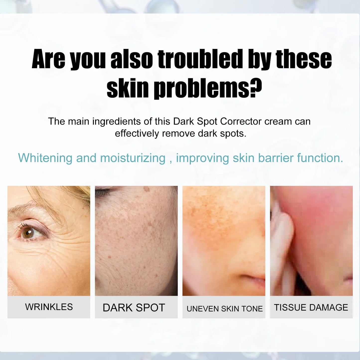 EELHOE Whitening Freckle Cream Nicotinamide Dark Spot Remover Skin Care Moisturizing Brighten Anti-aging Fade Spot Face Beauty