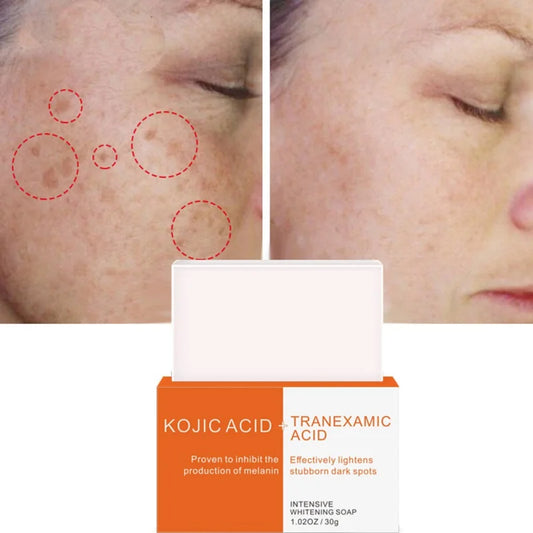 Face Washing Soap Facial Cleanser Kojic Acid Tranexamic Oil Control Pore Shrink Nourishing Sensitive Skin Care Beauty Health 30g