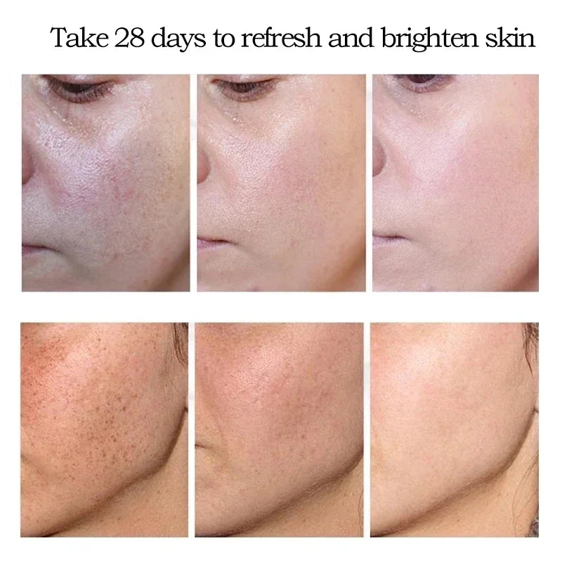 Face Dark Spots Remover for Women Remove Melasma Freckles Cream Removal Melanin Whitening Cream Fade Spots Skin Brightening Care