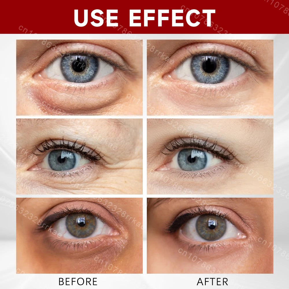 Eye cream removes eye bags puffiness dark circles eye wrinkles, Fade Eye Fine Line,  Anti Wrinkle whitens skin care