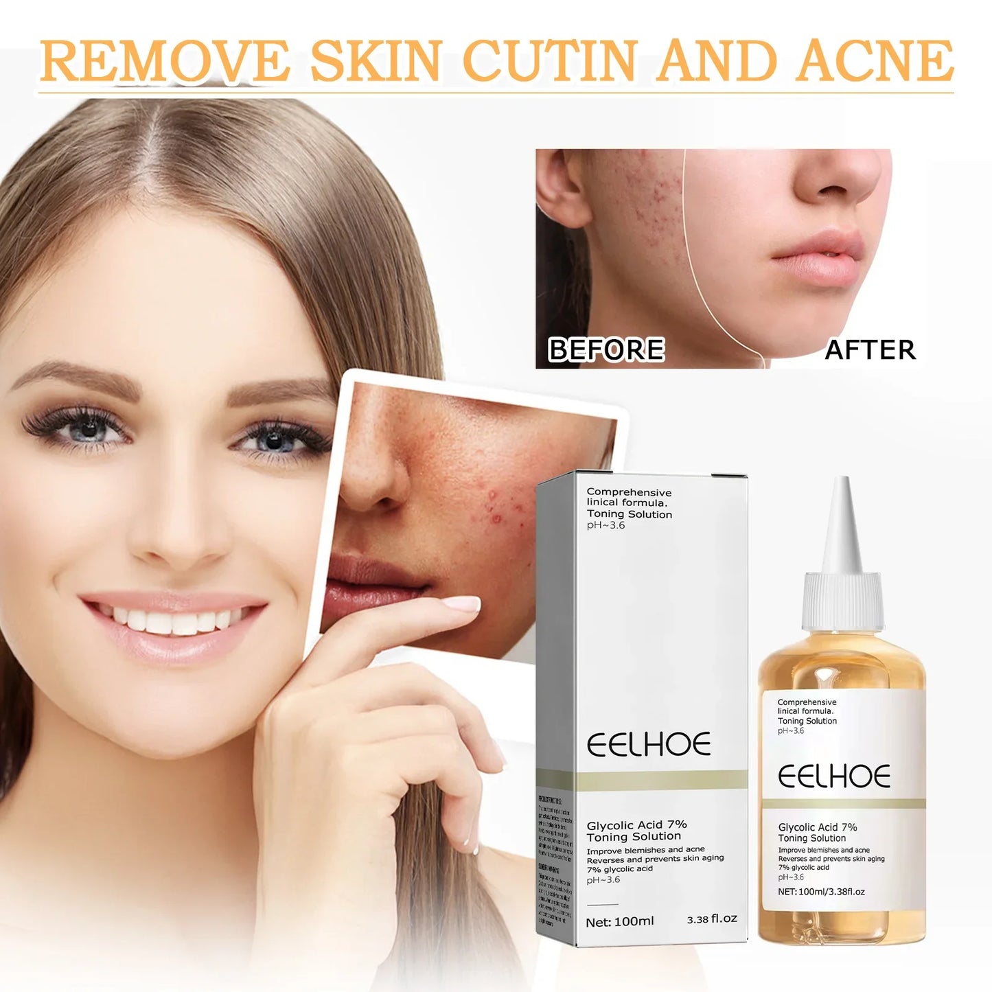 EELHOE The Glycolic Acid 7% Toning Solution 100ml Shrink Pores Repair Facial Oil Nourish Gentle Glycolic Acid Toner Face Essence