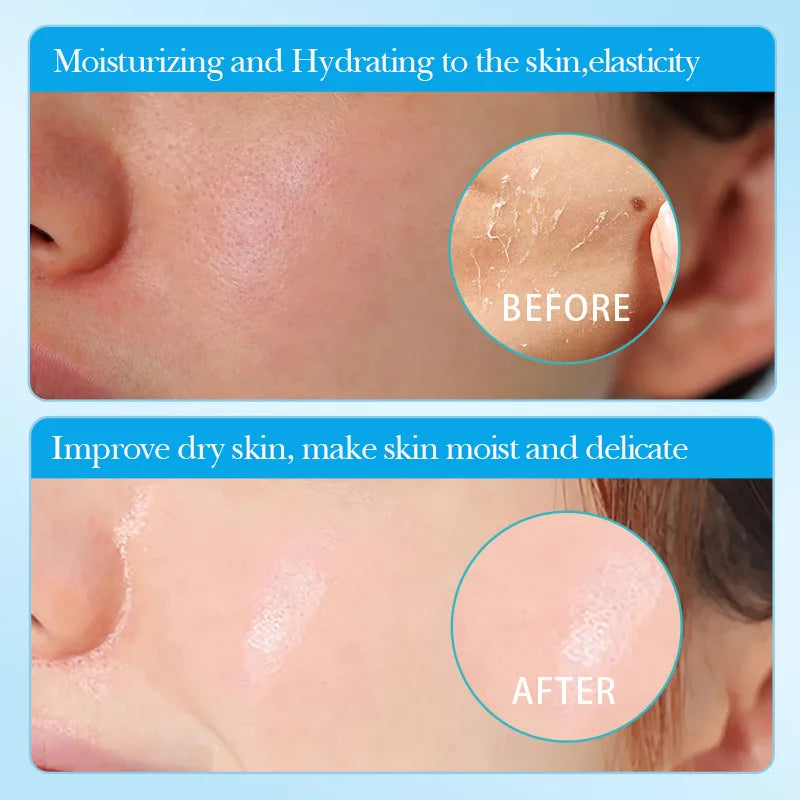 5/10/20pcs Hyaluronic Acid Hydrating Facial Mask Hydrating Shrinking Pores Sheet Face Masks Moisturizing Face Masks Skin Care