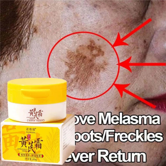 Astragalus Whitening Freckles Cream Face Dark Spots Remover Repair Products Removal Melasma Melanin Moisturiz Brighten Skin Care