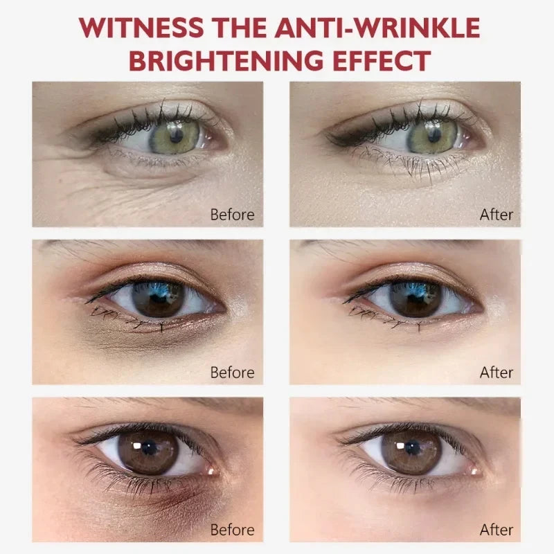 Nicotinamide Eyes Cream Dark Circles Remove Eye Bags Under Eye Hyaluronic Acid Moisturizing Serum Against Puffiness Eye Care Gel