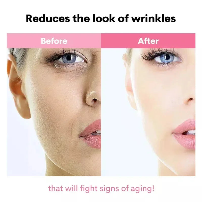 Original COSRX Snail Facial Essence /AHABHA/Cream Fade Fine Lines Anti-aging Lift Firm Acne Treatment Korean Skincare Products