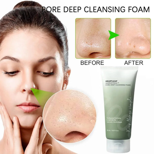 Anu Heartleaf 77% Skin Care Moisturizing Face Wash Foam for Blackhead Oil Control Pore Deep Cleansing Facial Cleanser 150ml