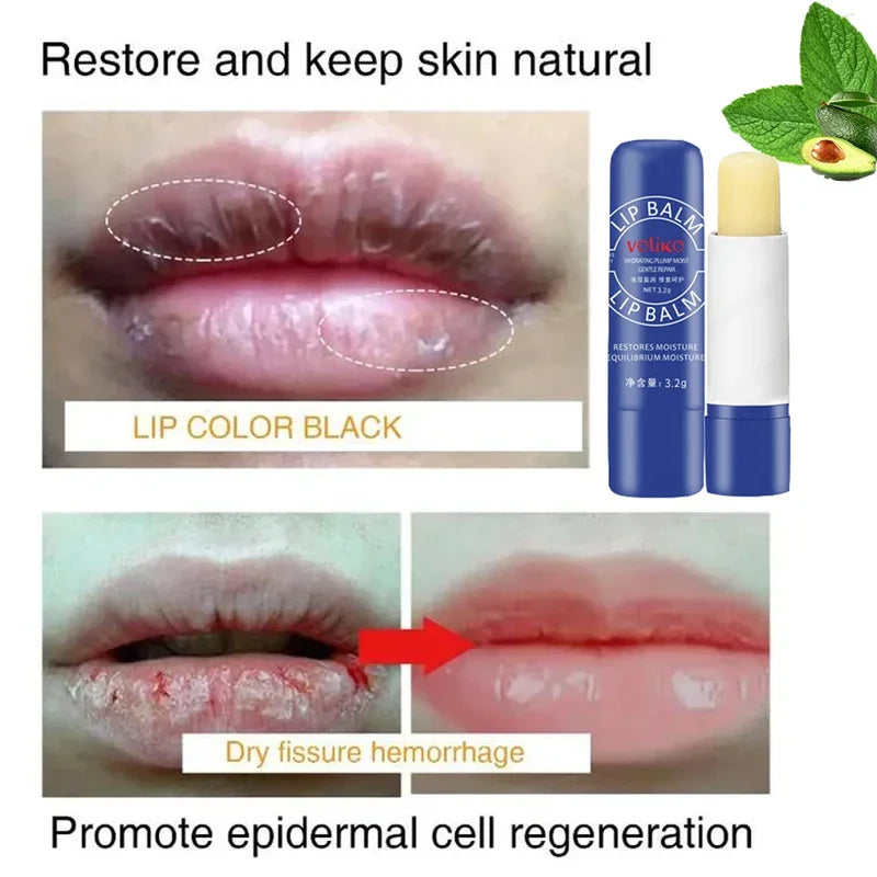 Lip Balm Remove Dark Lighten Melanin Lip Mask Exfoliating Dead Skin Fade Lip Line Moisturizing Brighten Repair Lip Care Products