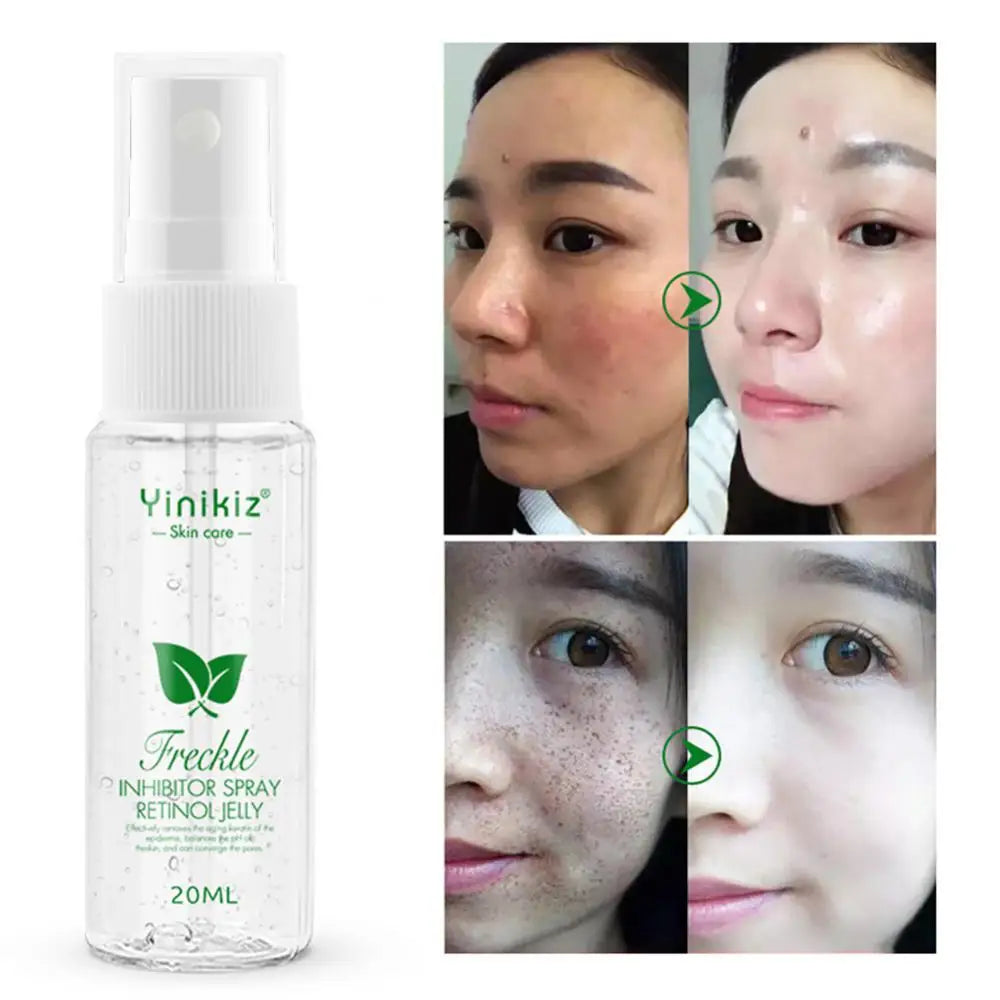 Face Moisturizing Spray Brightening Gel Improve Dryness Skin Sooth Refreshing Non Greasy Face Mists Skin Face Care Water