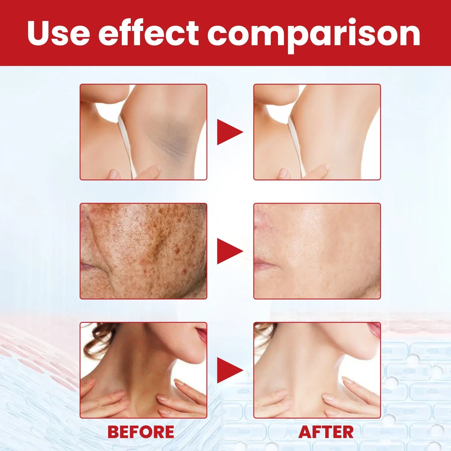 Dark Spot Remover Cream for Face Whiten Freckles Pigment Melanin Correcting Facial Essence Fade Age Spots Brighten Skin Care 30g